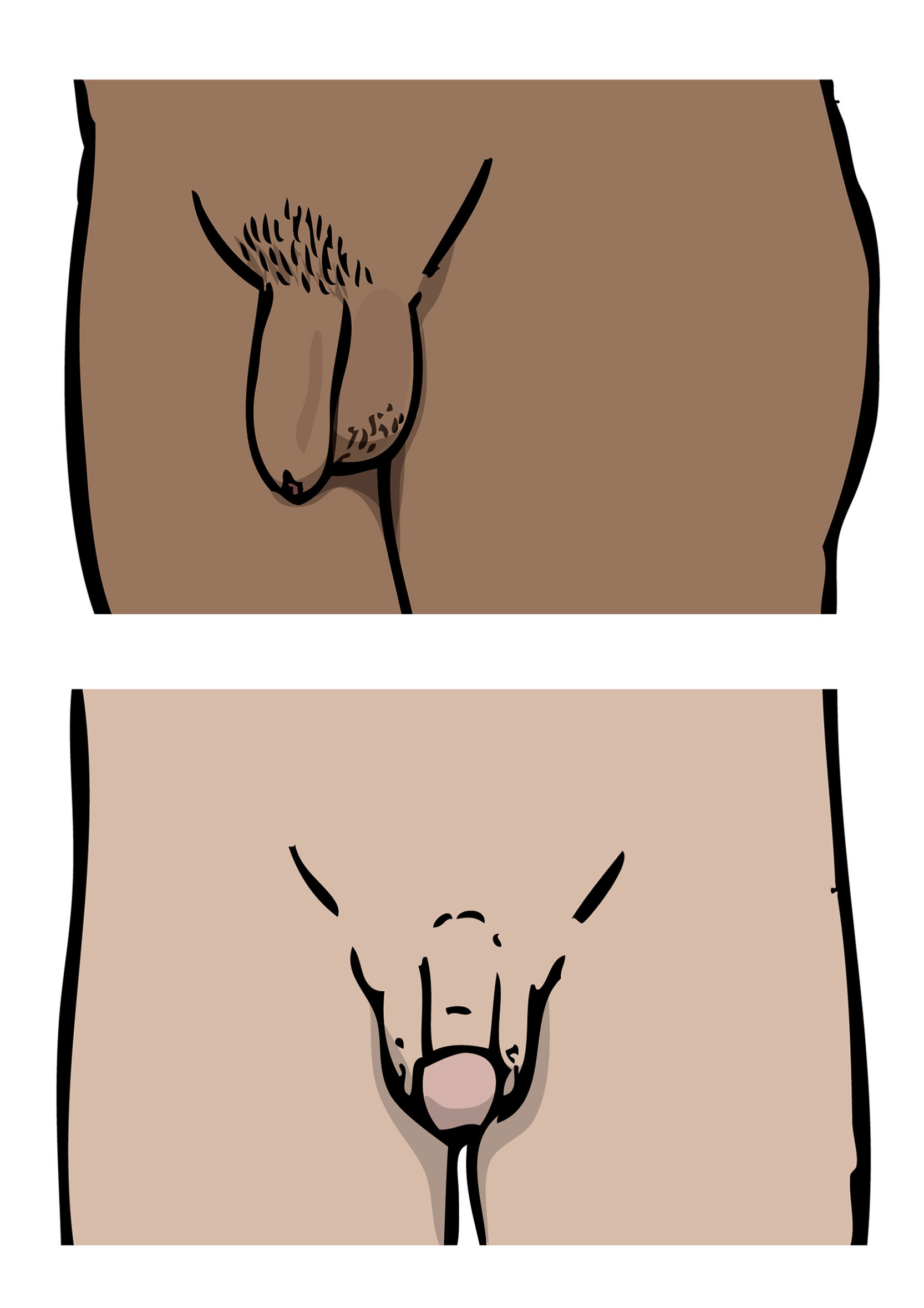 Illustrationer av två olika penisar som syns från olika håll.