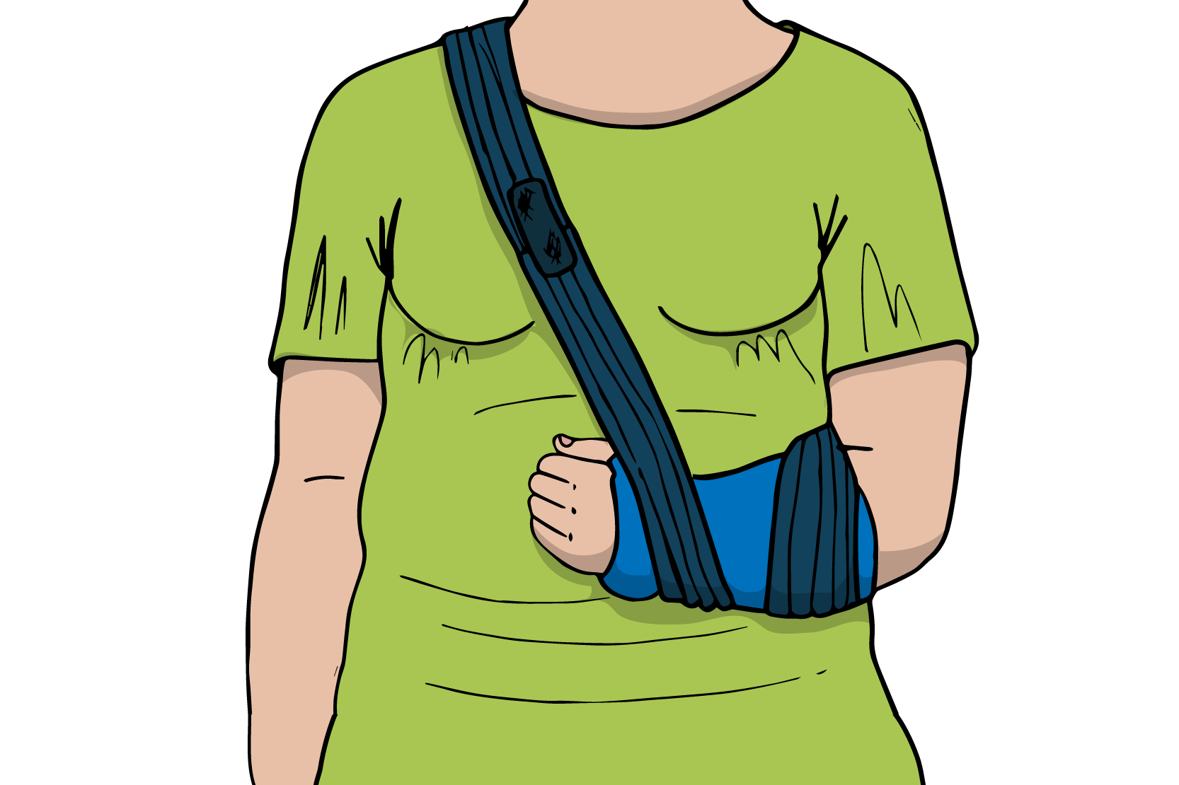 En person med ena armen i ett förband, illustration.