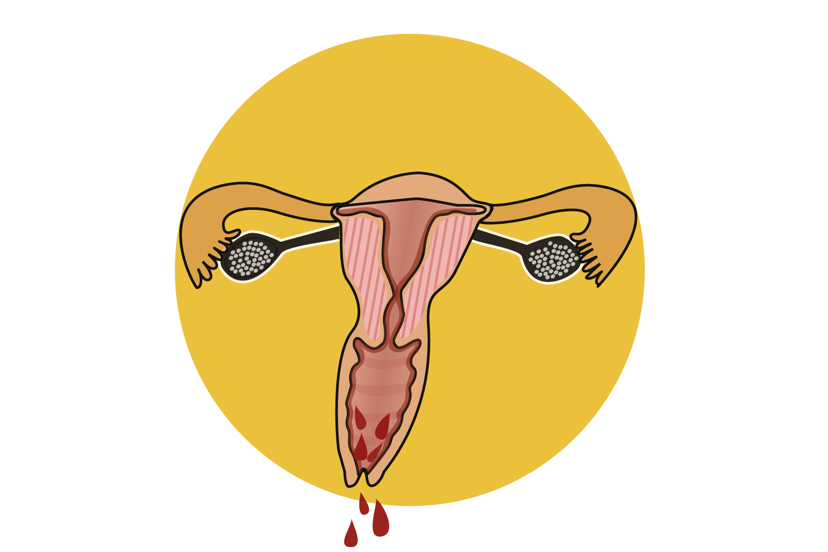 Illustration som visar äggstockarna, äggledarna, livmodern och blod som droppar från slidöppningen.