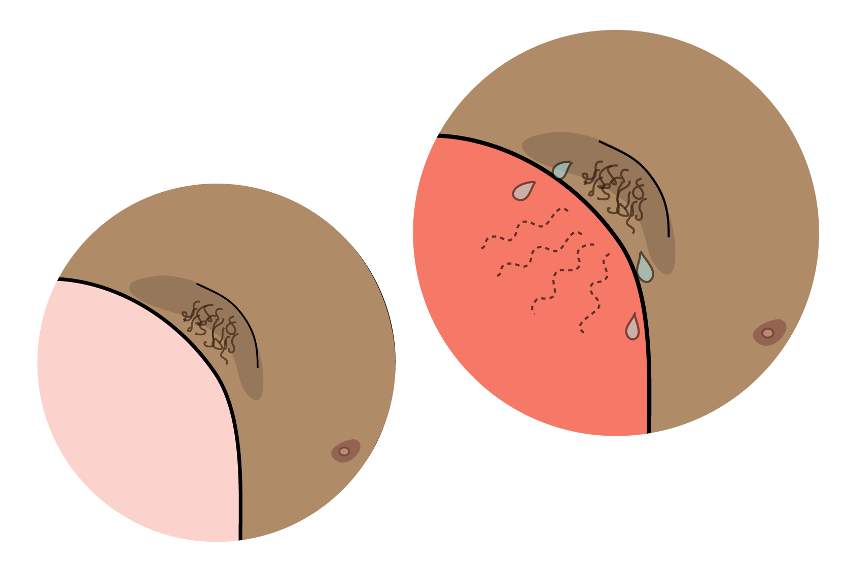 Två bilder på armhålor, där det kommer svettdroppar från den ena. Illustration.