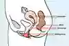 Illustration som visar hur en tampong sitter i slidan