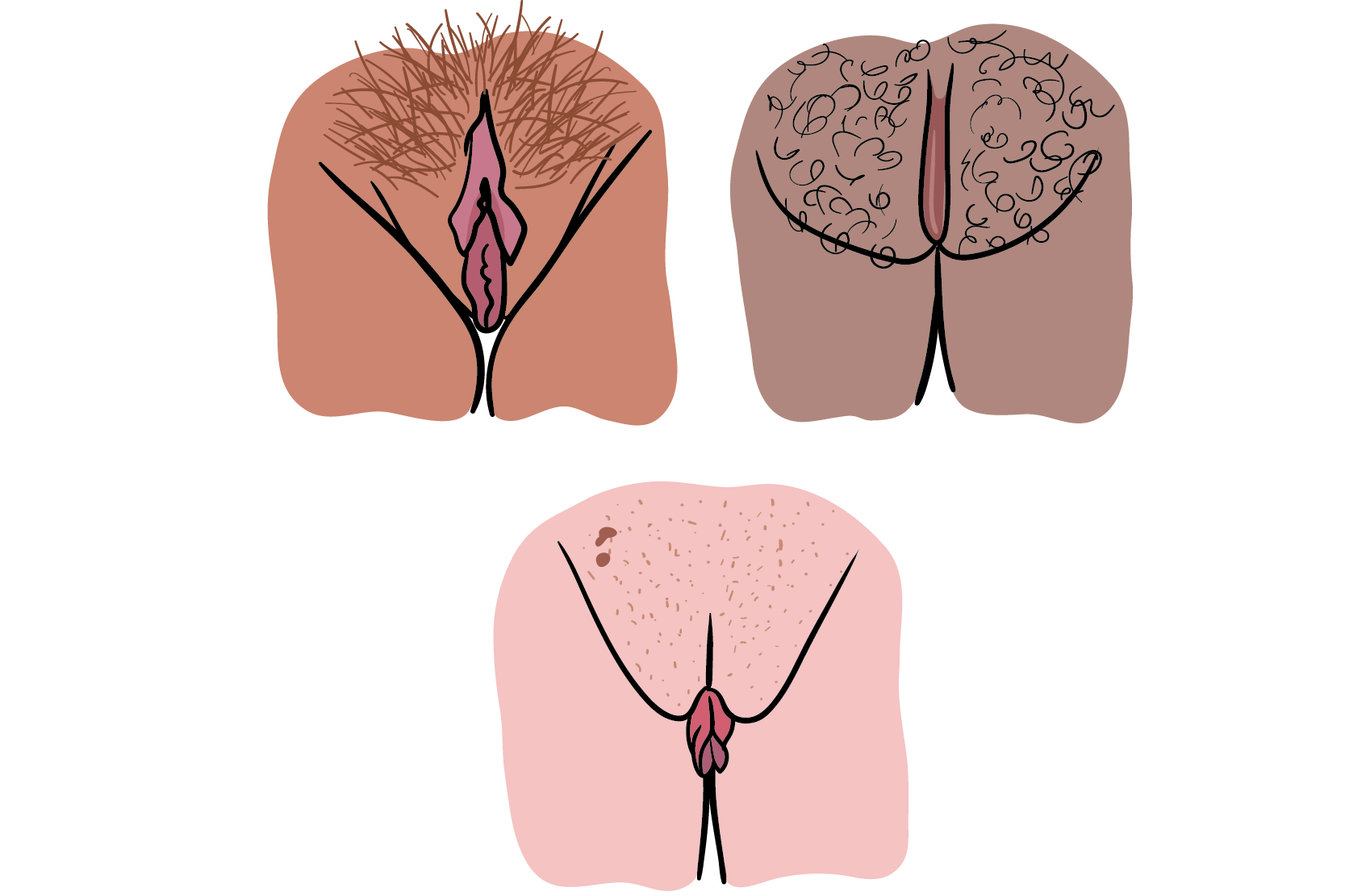 Tre olika vulvor med olika storlekar och former på inre och yttre blygdläppar.