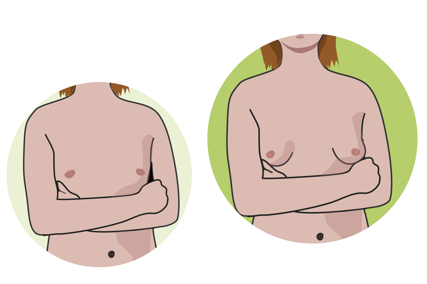 Två bilder av en persons nakna överkropp. På ena bilden har brösten inte börjat växa, men på den andra har de blivit rundare och större . Illustrationer.